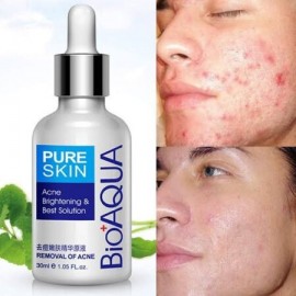 Serum anti acné BIOAQUA