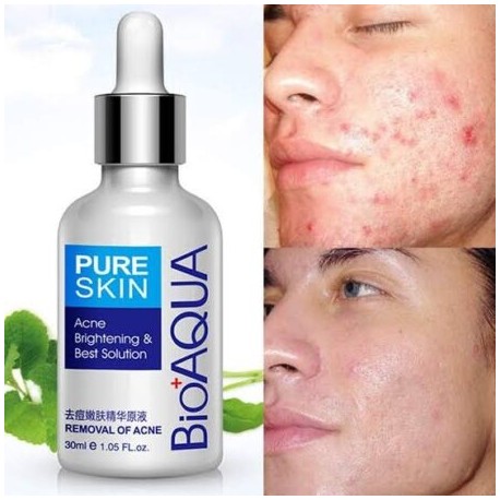 Serum anti acné BIOAQUA